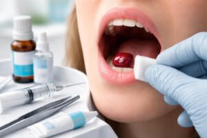 découvrez les différents traitements possibles pour une boule de sang dans la bouche, leurs causes, et les conseils pour soulager cette condition.